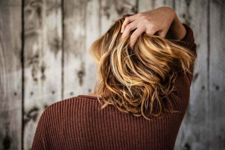 7 Home Remedies to Get Rid of Dandruff Naturally