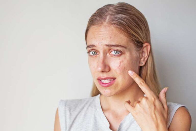 5 Common Skincare Mistakes For Oily Skin