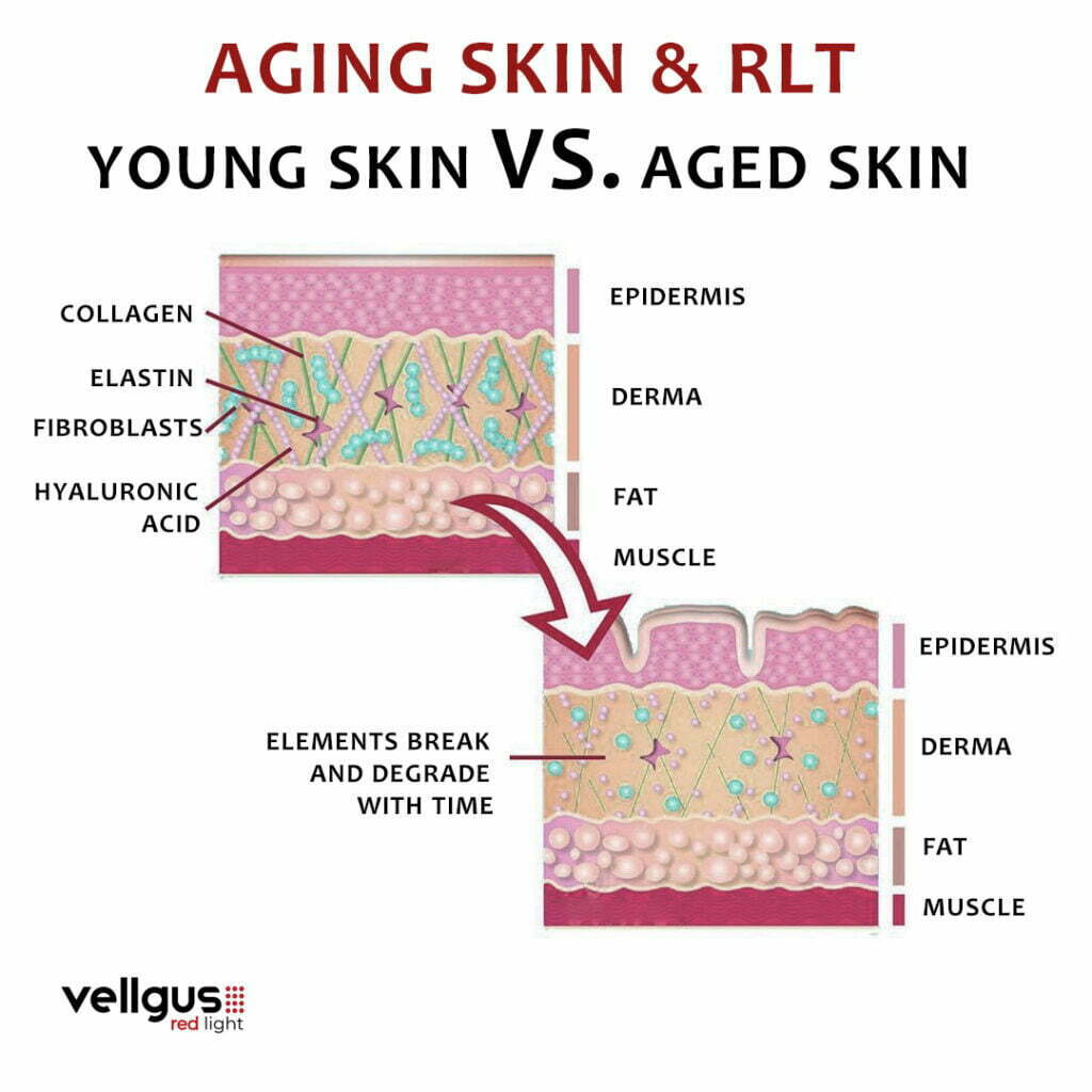 aging skin and red light therapy