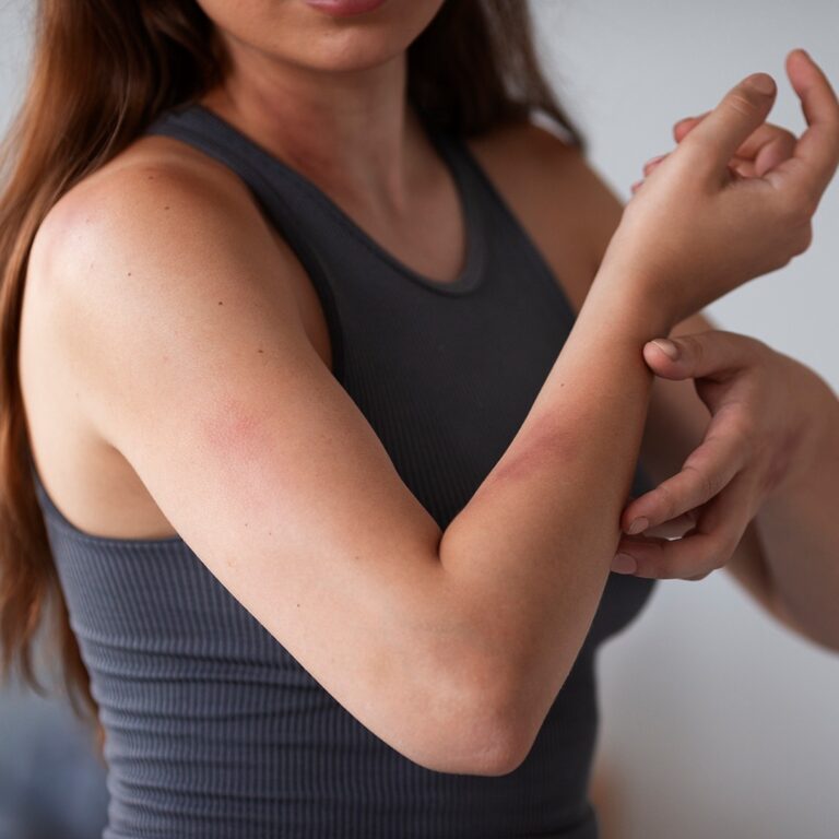 Do Carpet Beetles Bite? A Pest Expert’s Guide to the Real Problem